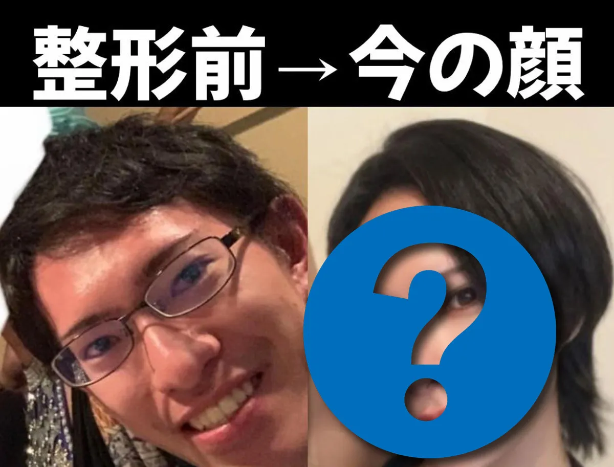 整形に700万円かけた男性美容外科医のリアルな体験談に1000万回再生「整形はダメじゃない、前に進もうとしている証拠」