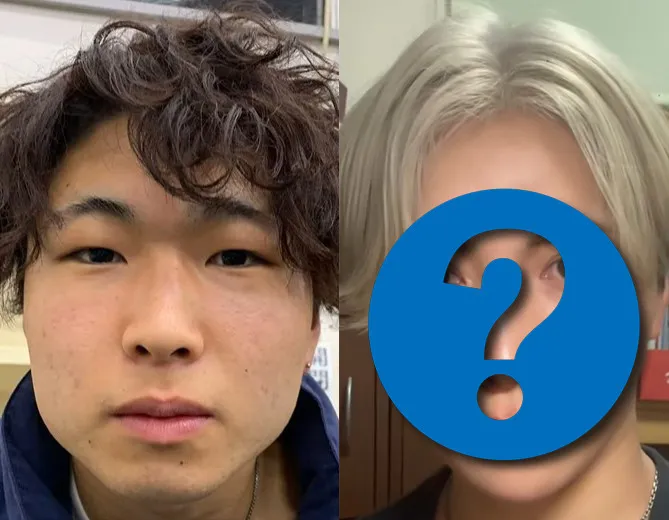 異性からの陰口に「整形で見返してやる」 200万で“K-POPアイドル”並のイケメンになった男性「整形は人生を取り戻す手段」
