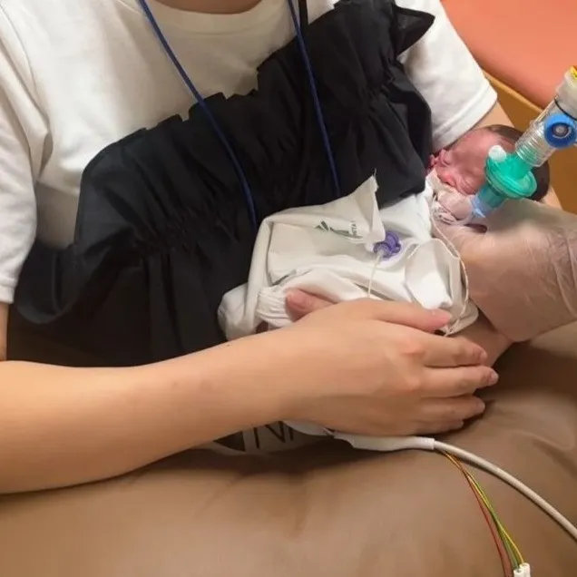 661gで生まれた小さな我が子…ダウン症や合併症と向き合う入院生活を経て「普通なら当たり前の成長が、何倍も嬉しい」