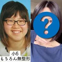 二重整形を3回失敗、下剤の過剰摂取も…外見すべてがコンプレックスだった女性、垢抜けるまでの10年間「成長するために過去があった」
