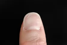 「爪の亀裂は放置しない」気分が落ちるだけじゃない…“爪の補修材”で爪トラブルも防ぐ