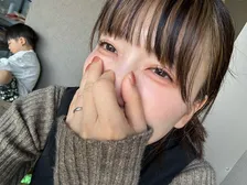 「つらい、つらすぎる…」ありのり・桃、レーザー治療も虚しく…ヤバすぎる花粉症の症状