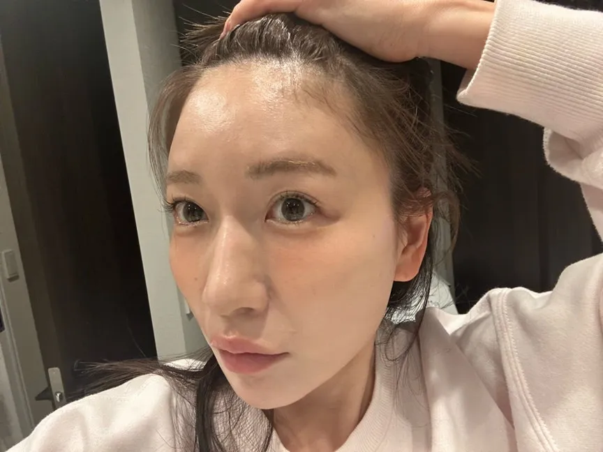 あいのり桃「ハゲてたの?!」「後退してる?!」　衝撃告白もファン「41歳に見えない若々しさ」「昔も今もかわいい」