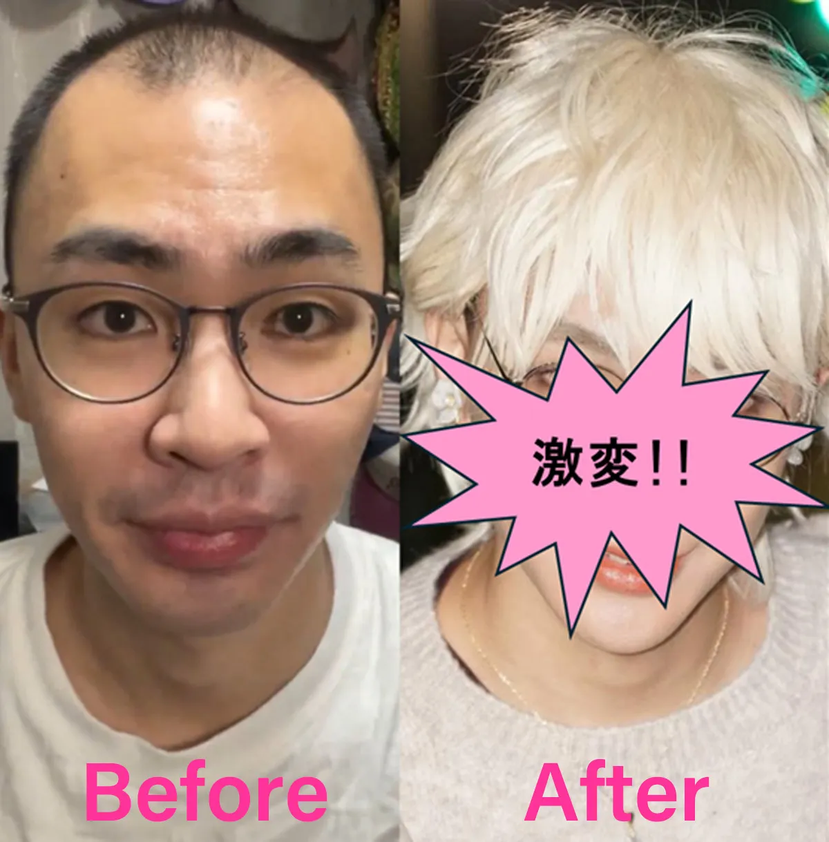 薄毛男性がメイクで爆イケメンに、ビフォーアフター動画が719万回再生「肌荒れも薄毛も隠しちゃえばいいじゃん！」