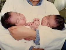 20年生きられる確証は無かった…結合双生児の姉妹と母親が分離手術から成人までを振り返る「振袖を着られたことは奇跡」「写真は宝物」