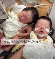 出産後に発覚、双子が2人ともダウン症…前を向く覚悟を決めた夫婦の想い「全力で応援して、愛情を注いでいきたい」