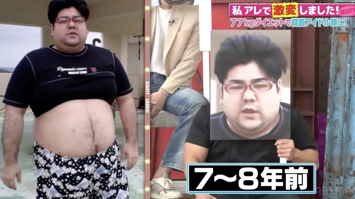 145キロ→77キロのYouTuber、“激変”したビジュに香取慎吾ら騒然「違う人だろ！」　2週間で15減キロ減に成功するも…生じた異変