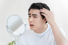 この抜け毛はAGA？ “毛のミニチュア化”の恐怖…、医師が「注意すべきクリニック」の特徴も提言
