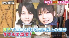 双子で整形、総額4000万円　顔へのコンプレックスは中学時代“周囲から比較”「姉の方が可愛い」