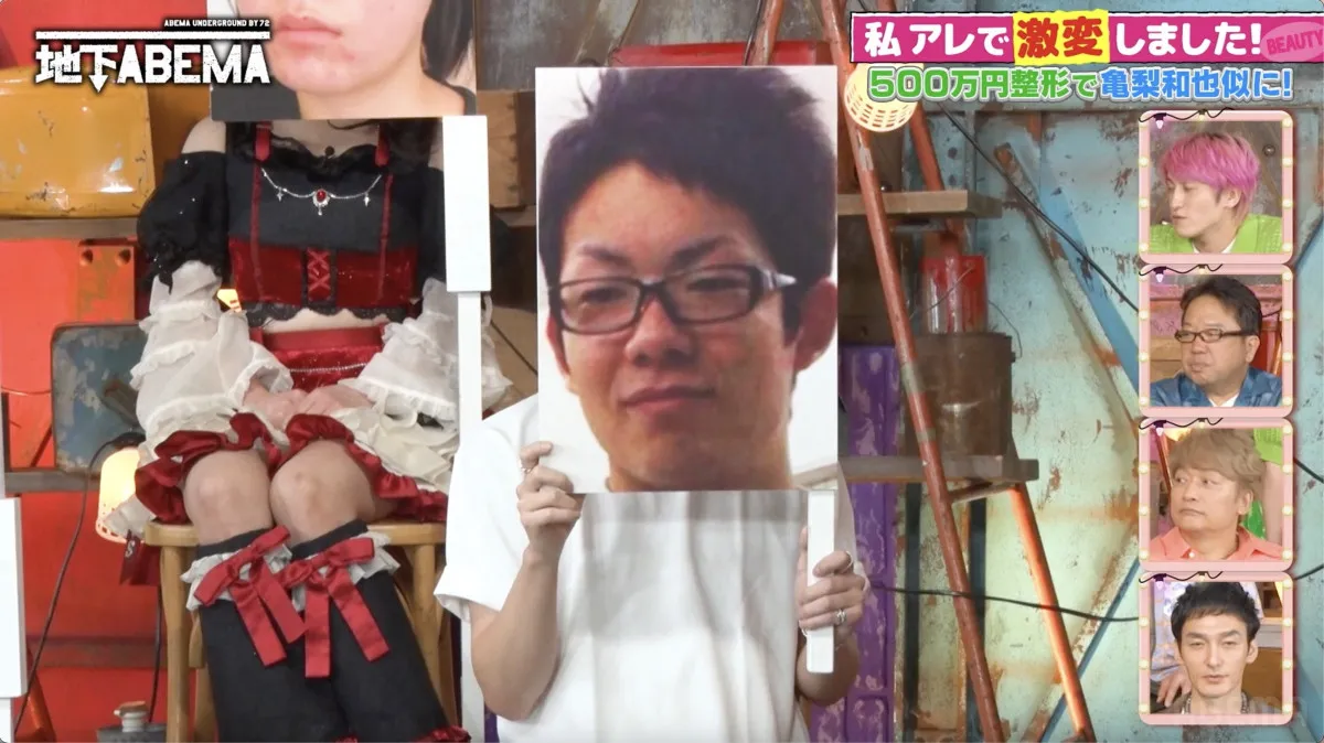 整形総額500万円で亀梨和也似に激変！きっかけは彼女の浮気＆ホスト不合格