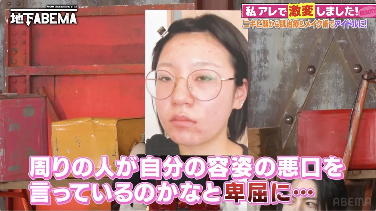 「周りの人が自分の悪口を言っているのでは…」肌荒れから卑屈に…一念発起で治療とメイクを猛勉強→まさかのアイドル転身