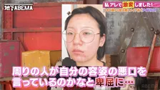 「周りの人が自分の悪口を言っているのでは…」肌荒れから卑屈に…一念発起で治療とメイクを猛勉強→まさかのアイドル転身