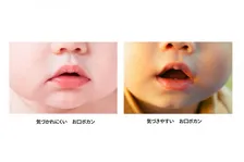 「お口ポカン」防止トレーニングで、子どものお口の悩みに貢献。