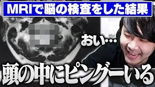 MRI検査で頭の中にピングーを飼っていることがバレるk4sen【雑談/Deviation Game】