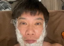【 TKO・木本武宏 】　人生初「顔のイボ取り」を報告　「細かく100個くらいあるんやって　まず今日はまず30個ほど取る」