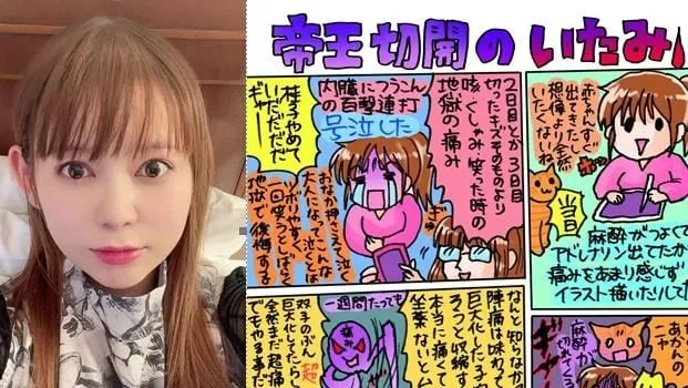 【中川翔子】「お腹痛すぎる　まだ後陣痛？が全然やばい」帝王切開出産後の痛みを絵日記で報告