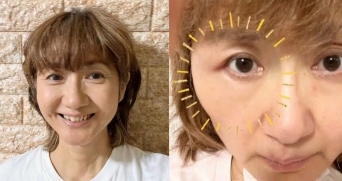 【がん闘病】古村比呂さん　帯状疱疹の影響か　右目横の筋肉「プクッと腫れている」　朝には38.1度の発熱も「今は安静第一」