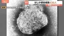 今年のはしか感染者数436人に　去年の約4.5倍のペースで拡大　感染のピークは4月中旬から6月下旬と推定 最悪の場合1年間で1600人超に達する可能性も