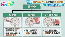 40代から増加「脳梗塞」の初期症状は？「倒れてからじゃ遅い」早期発見のカギ「BE FAST」とは【ひるおび】