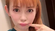 【中川翔子】「体調悪いとなるクインケ浮腫」「くちびるが腫れてしまった」痛々しい画像を投稿