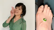 【 石原詢子 】放射線治療が折り返しに　「今は上手に付き合うしかないですね・・」足の浮腫対策を明かす