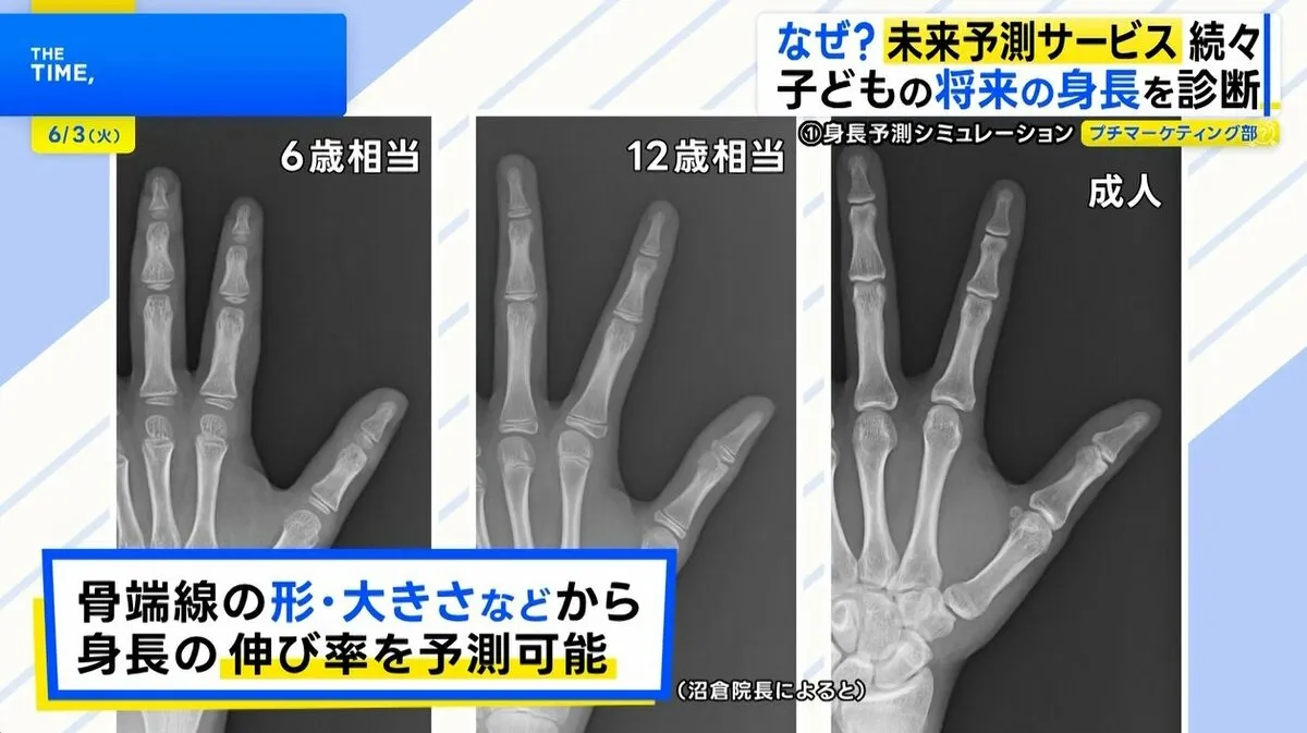 将来の「身長」から「視力」、「病気のリスク」まで…広がる“未来予測サービス”【THE TIME,】