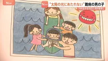 “太陽の光にあたれない”難病「色素性乾皮症」の男の子（5）「今を生きる大切さ」母が絵本に