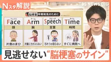 治療は「早期発見がカギ」　“夏の脳梗塞”は熱中症とそっくり？見逃せない“サイン”とは？【Nスタ解説】