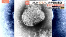今年のはしか感染者数479人 前年同期比4.1倍に　東京都が約半分の人数占める