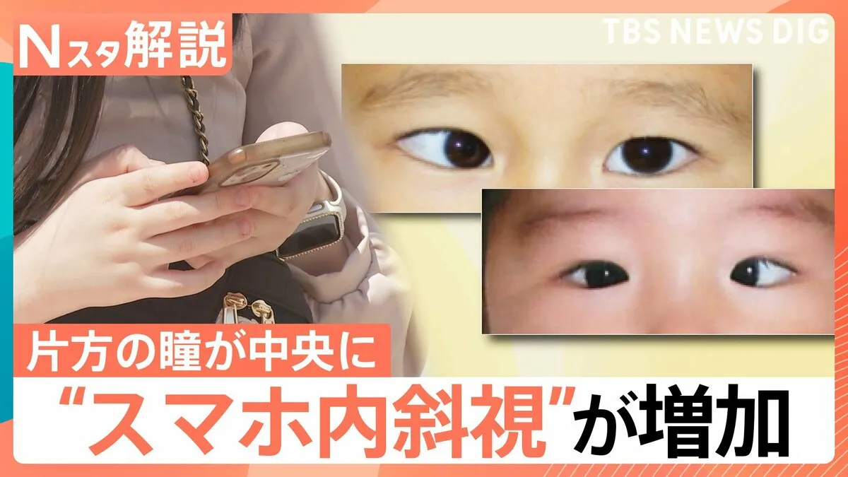 スマホ・携帯ゲーム見過ぎで瞳が…“スマホ内斜視”あなたは大丈夫？簡単セルフチェックで確認を！【Nスタ解説】