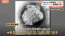 「はしか」感染者数 前年同期比4倍以上に　今年累計139人 2020年以降最多