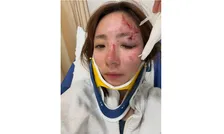 【 釣りアイドル・神野梓 】　運転中に事故　命を救った「iPhoneの『衝突事故検出』機能」　強い衝撃を感知後　「反応がないと119や緊急連絡先に自動通報してくれます」