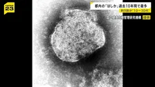 10年間で過去最多の132人 　都内の「はしか」感染者　10代～30代が9割近く