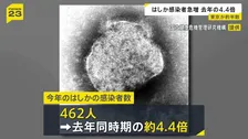 はしか感染者数462人　東京都が半分ほど占める