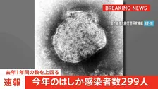 【速報】今年のはしか感染者数299人　去年1年間の数を上回る　国立健康危機管理研究機構
