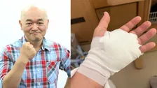 【 高橋名人 】“16連射” への影響はなし　左手の「ばね指」手術終了を報告「そもそも連射は右手」　術後の経過とリハビリへの意気込み明かす
