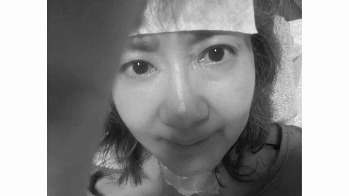 【がん闘病】古村比呂さん　帯状疱疹「頭皮に出来た水ぶくれがかさぶたになりにくく滲出液のようにジクジクとまだ滲み出ています」