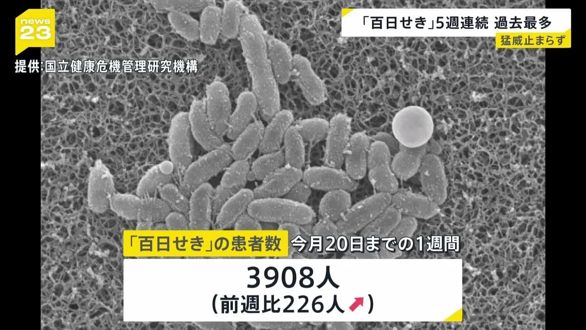 「百日せき」の患者数が5週連続で過去最多を更新　最多は東京で310人