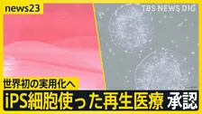世界初の実用化へ iPS細胞を使った2つの再生医療製品 条件期限付きで承認　早ければ今夏にも【news23】