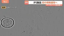 iPS細胞使った再生医療製品 公的医療保険の適用を了承　パーキンソン病治療“年内に1人目の移植を目指す”
