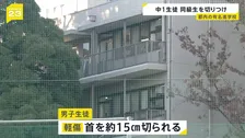 中学1年の男子生徒が同級生にカッターで首を切りつけられる 当時は自習時間で教室内に教職員は不在　私立・武蔵高等学校中学校