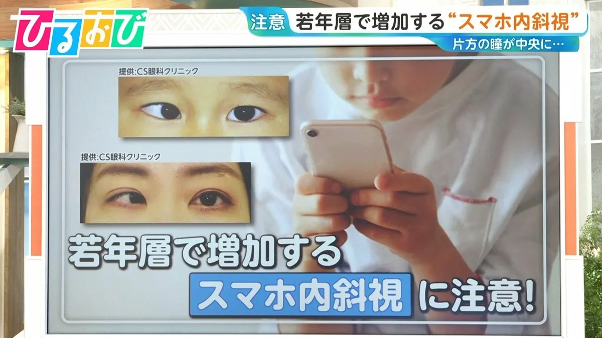 スマホやゲーム機を長時間近くで…子どもの“スマホ内斜視”が増加　対策は？【ひるおび】