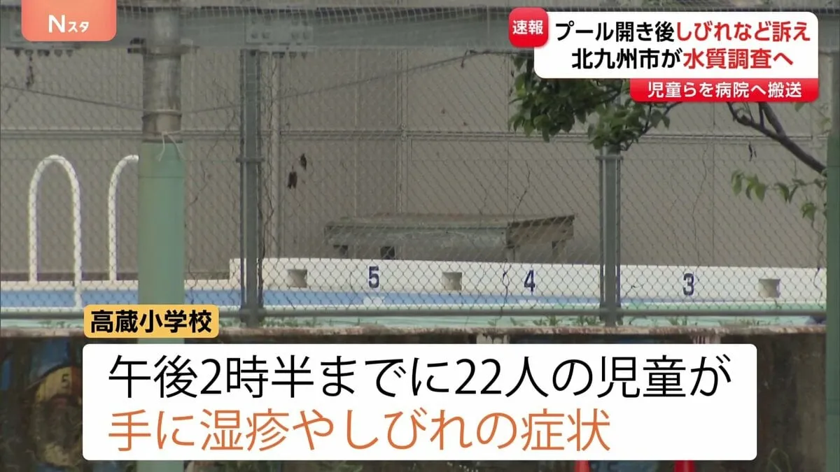 【速報】小学校のプール開き後 複数の児童が湿疹やしびれ 病院に搬送 福岡・北九州市 高蔵小学校 市は水質調査などで原因を調べる