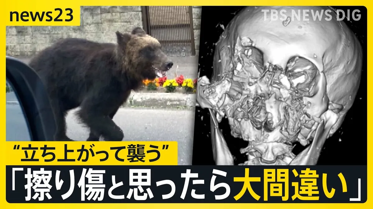「最初の一撃で肋骨6本折れた」 クマに襲われた男性が警鐘「獣害ではなく災害」 深刻化する被害…老人ホームの裏に“3時間居座り”も【news23】