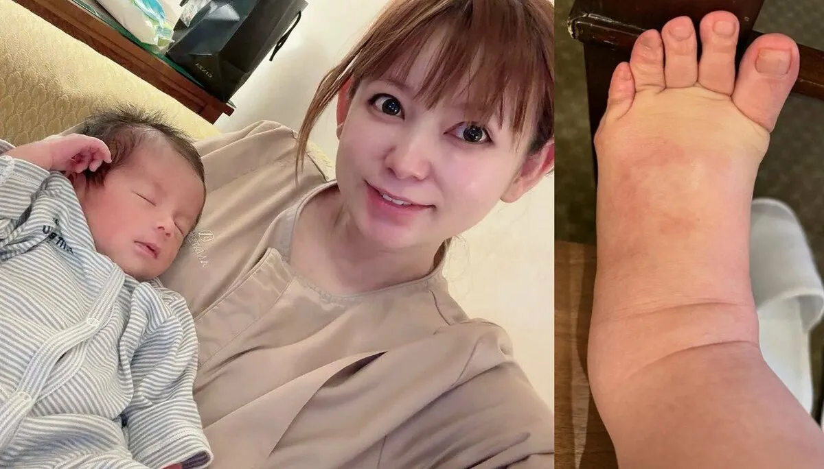 【 中川翔子 】 「双子ワンオペ無理」「大変さもあるけどそれ以上に愛おしい」　現況明かす　「むくみとのたたかい　着圧ソックス履く前と履いた後の違いがすごすぎる」