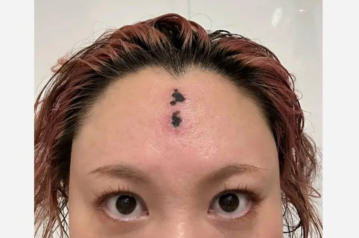 【 バービー 】 「ただの悪化した虫刺されです」　ＳＮＳにつづる　「Instagramがこの額を梵字のタトゥーと認識したのか…」　ファンも心配　「跡残らず治ります様に､､」