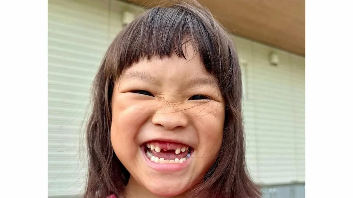 【ののちゃん】　「給食の時間に抜けた歯を、なくさないようにと手で握りしめて帰ってきました」 上の前歯が抜けたことを報告