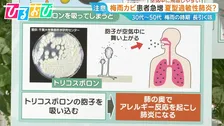 梅雨の長引く咳…白いカビが原因？「夏型過敏性肺炎」に注意【ひるおび】