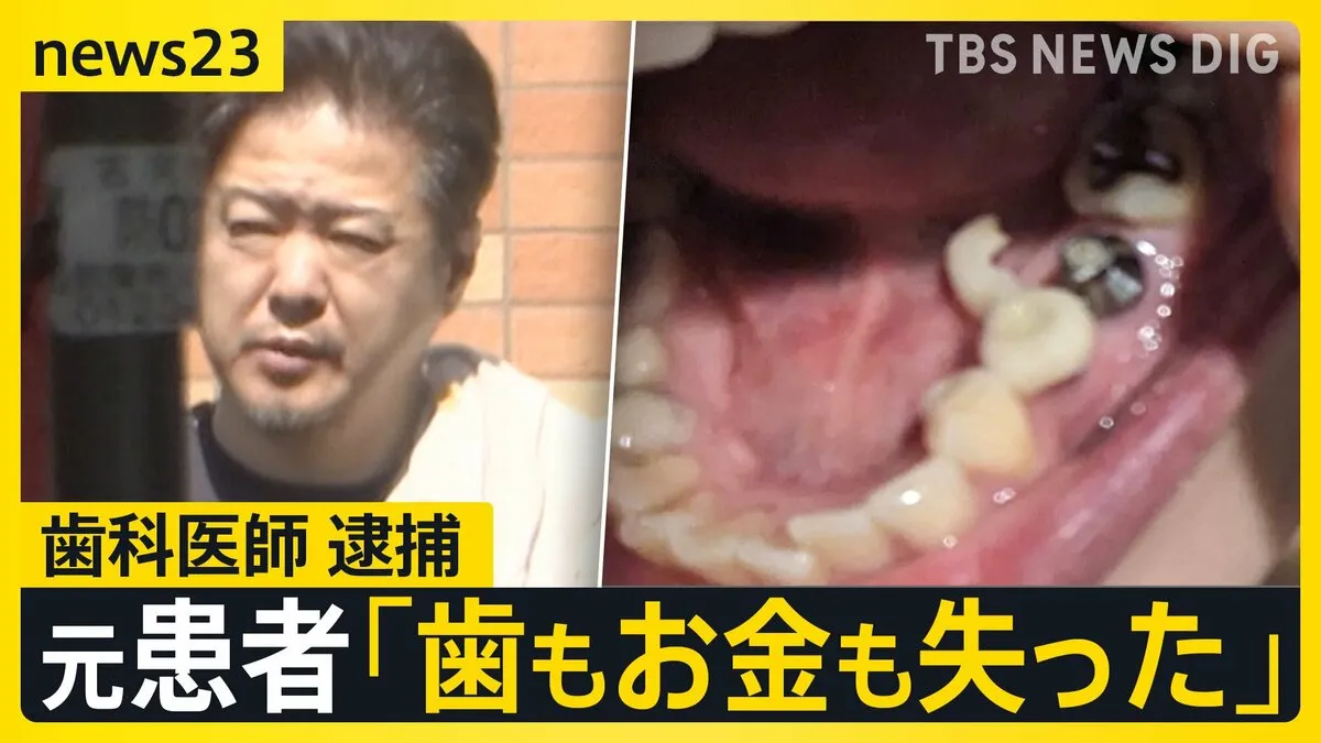歯科医師が患者から1億円以上詐取か “治療費返還”とうそで集金も 逮捕前の直撃に男は…【news23】