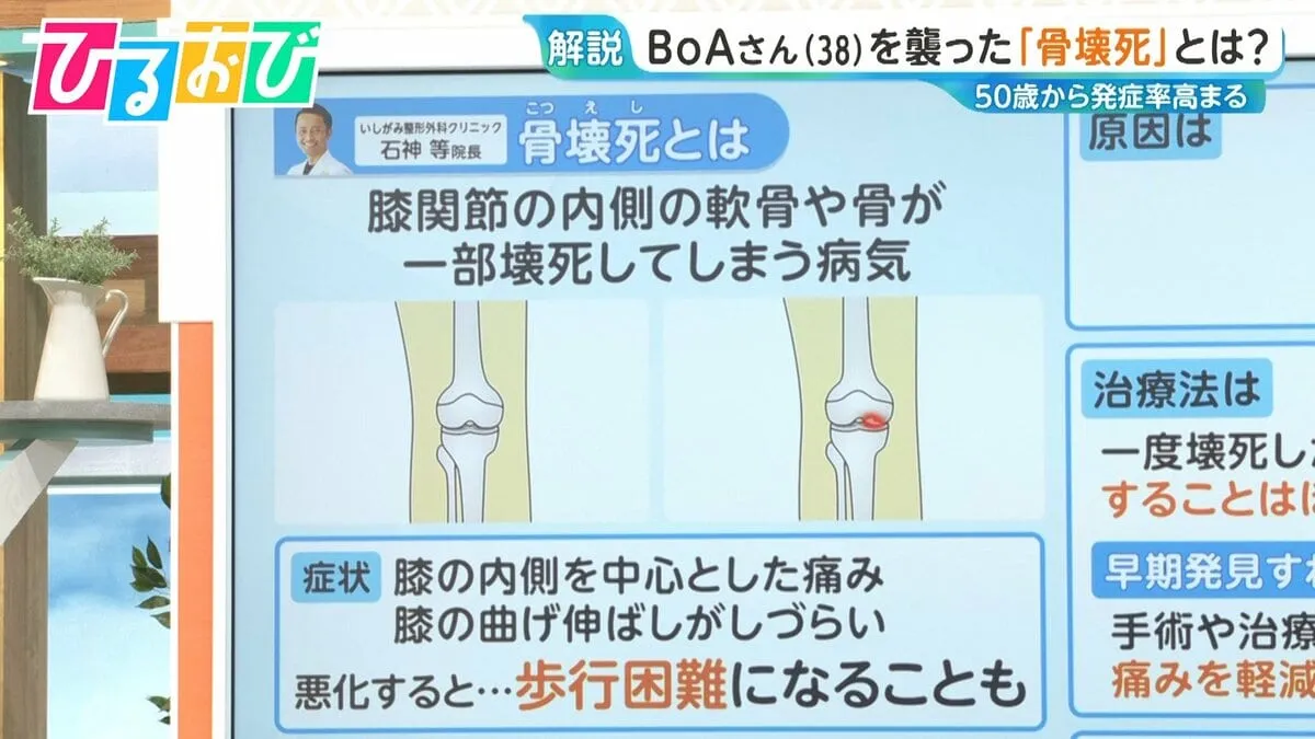 原因は不明『骨壊死』とはどんな病気？治療法や気を付けるべきことを専門医に聞く【ひるおび】